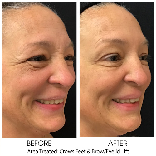 Before + After Gallery: Face