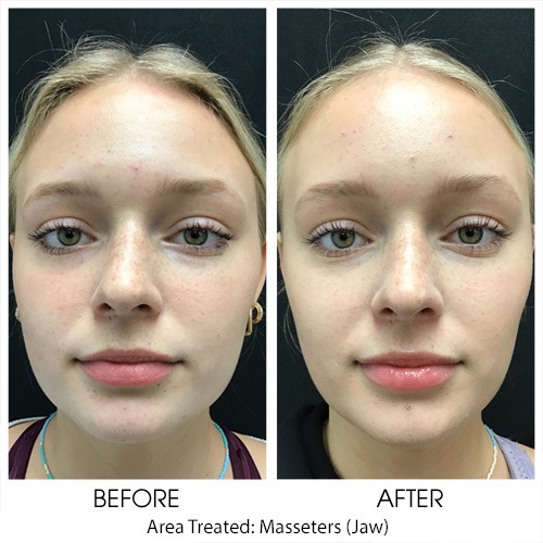 Before + After Gallery: Face
