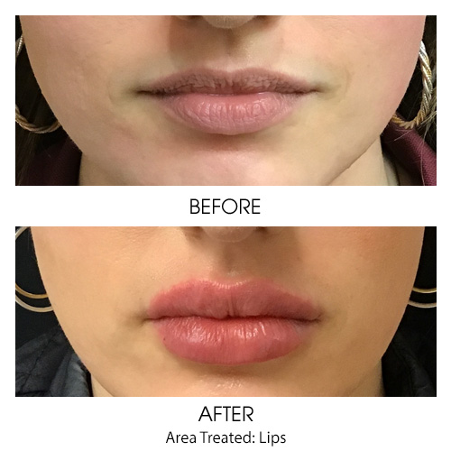 Before + After Gallery: Face