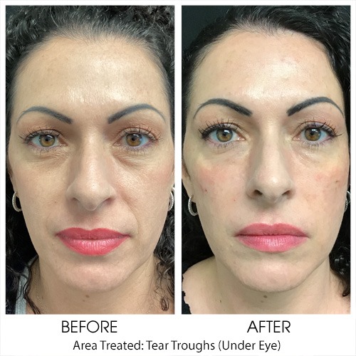 Before + After Gallery: Face