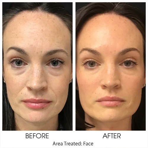 Before + After Gallery: Face