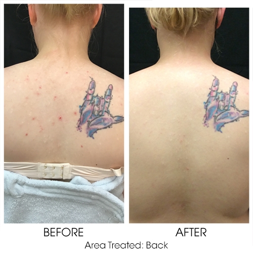 Before + After Gallery: Face