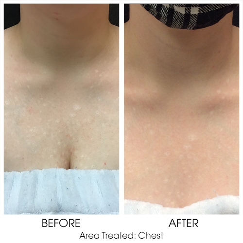 Before + After Gallery: Face