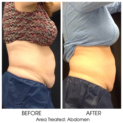 Before + After Gallery: Body