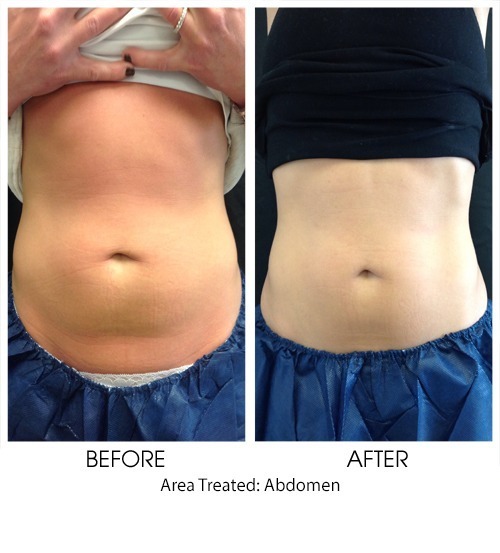 Before + After Gallery: Body