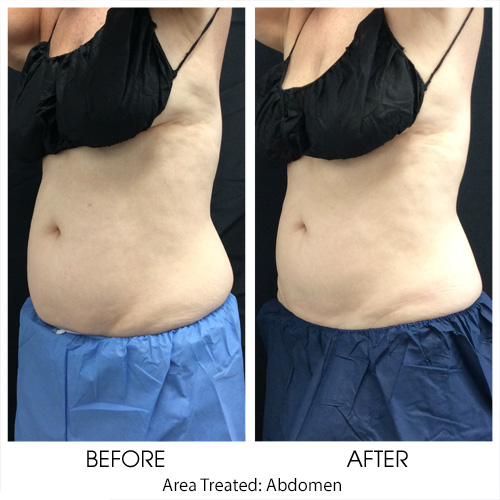 Before + After Gallery: Body