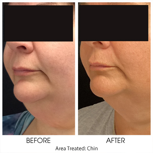 Before + After Gallery: Body