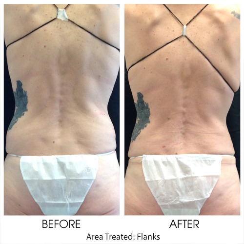 Before + After Gallery: Body