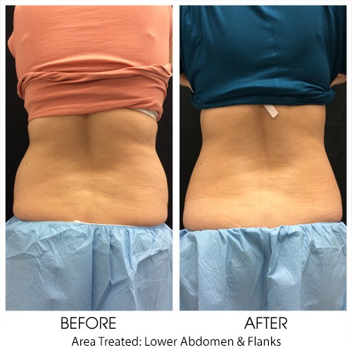 Before + After Gallery: Body