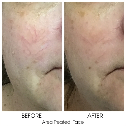 Before + After Gallery: Face
