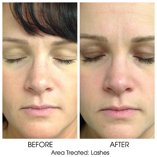 Before + After Gallery: Face
