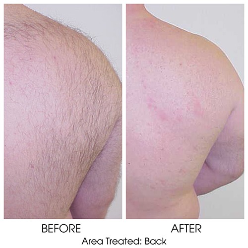 Before + After Gallery: Body