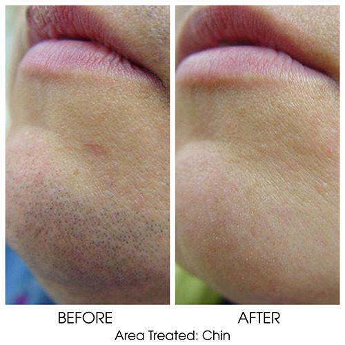 Before + After Gallery: Body