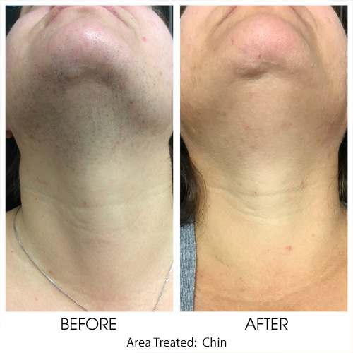 Before + After Gallery: Face