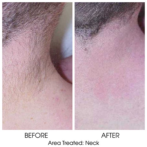 Before + After Gallery: Body
