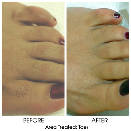 Before + After Gallery: Body