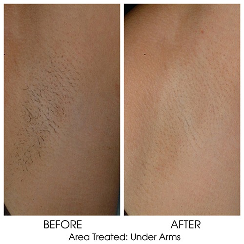 Before + After Gallery: Body