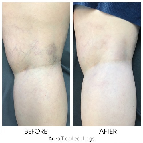 Before + After Gallery: Body