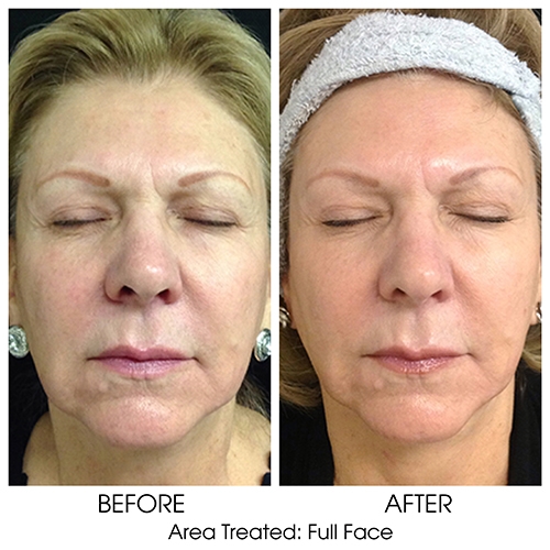Before + After Gallery: Face