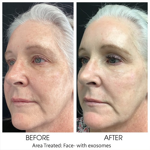 Before + After Gallery: Face