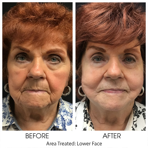 Before + After Gallery: Face
