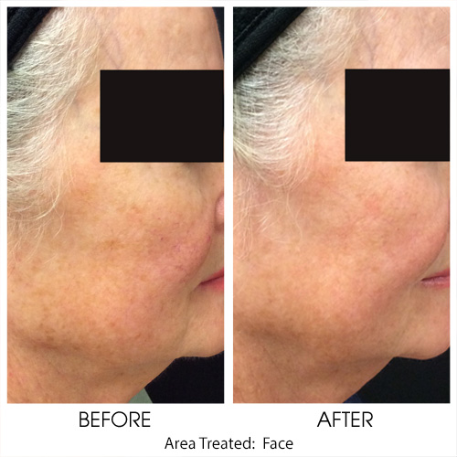 Before + After Gallery: Face
