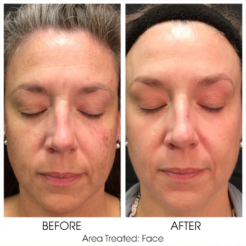 Before + After Gallery: Face