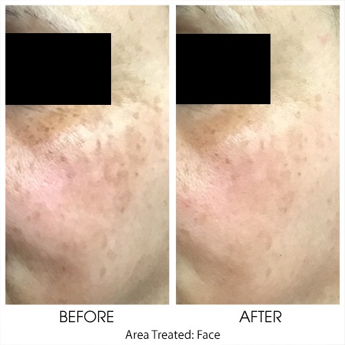 Before + After Gallery: Face