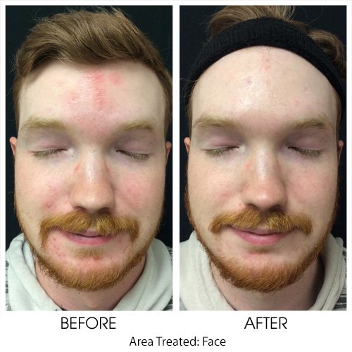 Before + After Gallery: Face