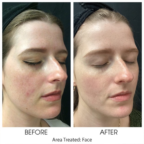 Before + After Gallery: Face