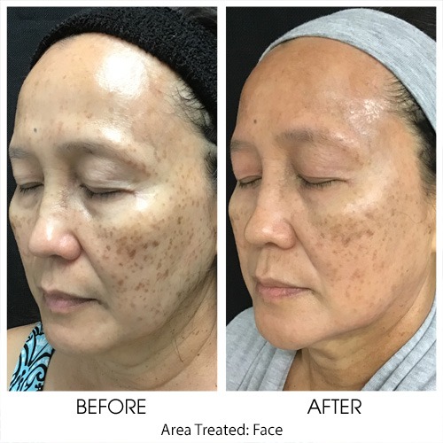 Before + After Gallery: Face