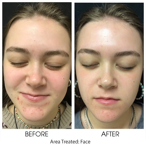 Before + After Gallery: Face