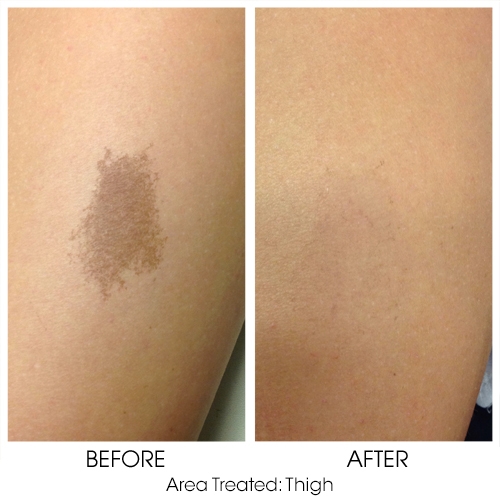 Before + After Gallery: Face
