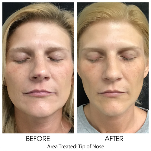 Before + After Gallery: Face