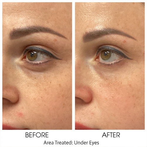 Before + After Gallery: Face